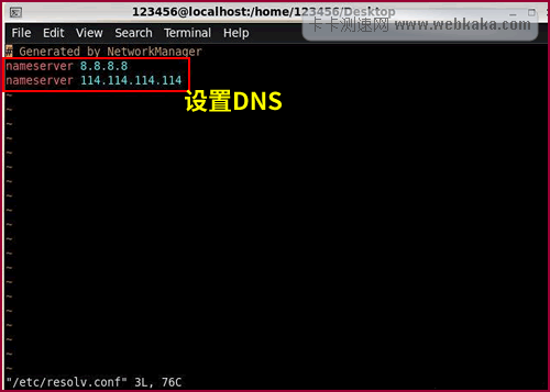 Linux設置DNS